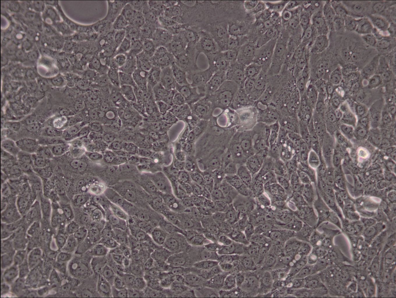 人胰腺导管癌细胞CFPAC-1(STR鉴定正确)