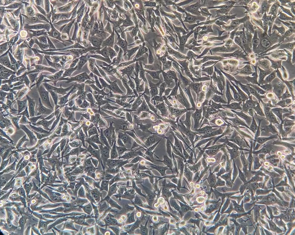 小鼠黑色素瘤细胞B16-F10（种属鉴定）
