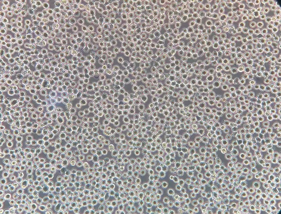 人急性淋巴细胞白血病T淋巴细胞CCRF-CEM(STR鉴定正确)