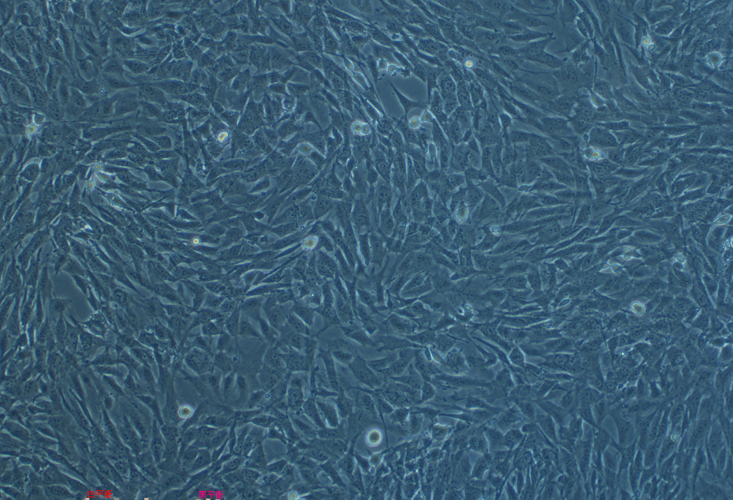 人骨肉瘤细胞SJSA-1 (STR鉴定正确)