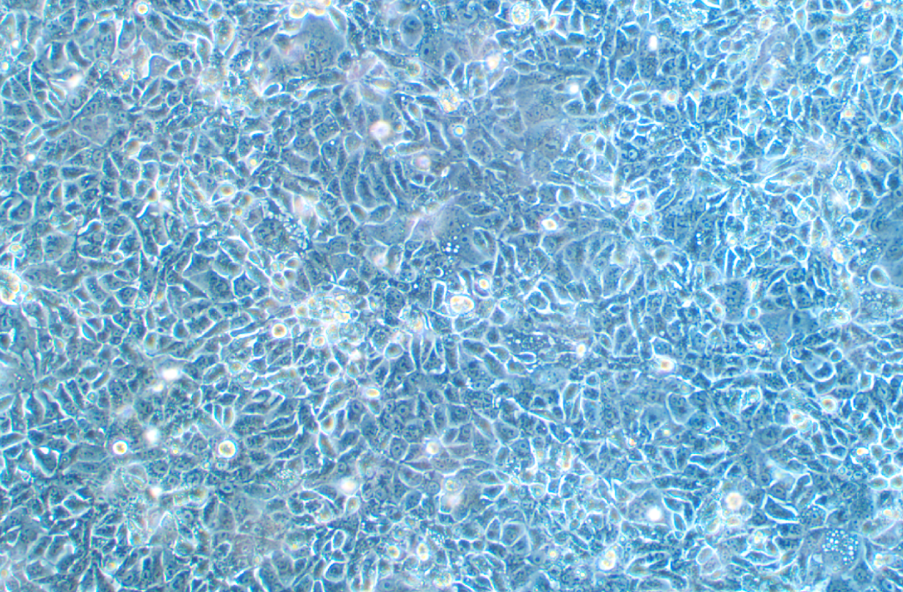 人肺腺癌细胞HCC78(STR鉴定正确)