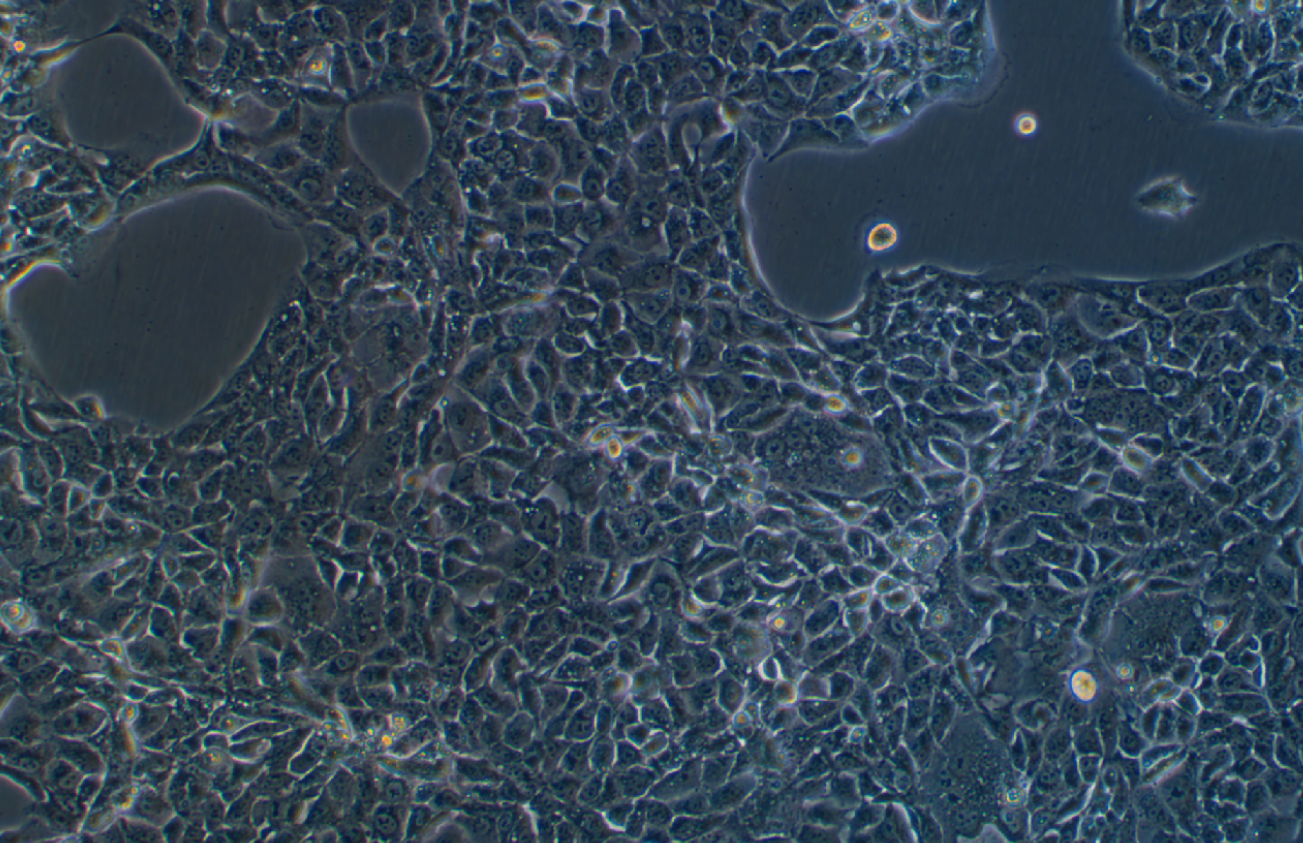 人肺腺癌细胞HCC78(STR鉴定正确)