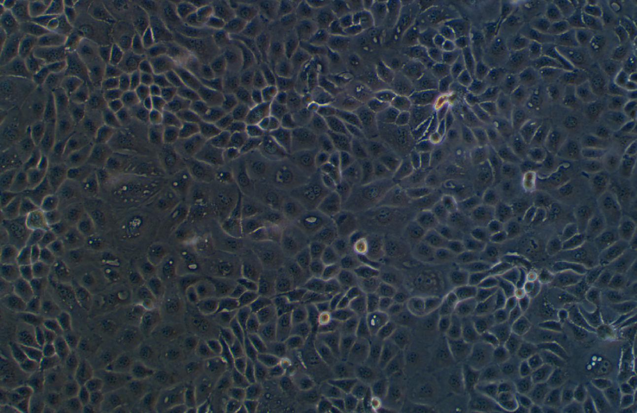 人卵巢癌腺癌细胞NIH:OVCAR-3(STR鉴定正确)