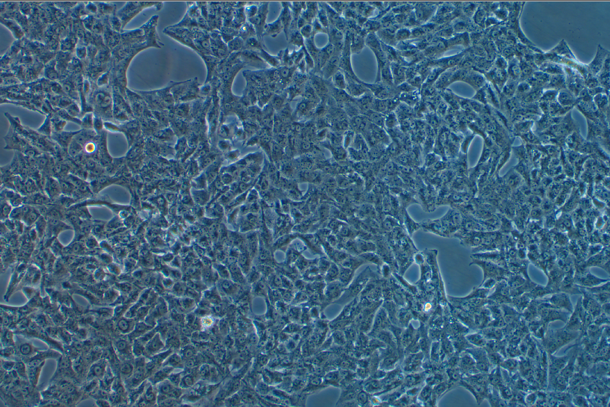人肾癌细胞SN12C(STR鉴定正确)
