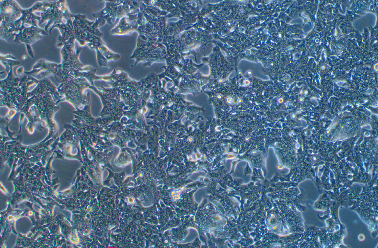 人直肠腺癌细胞SW837(STR鉴定正确)